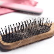 Haarausfall, viele Haare an einer Bürste Haarausfall, viele Haare an einer Bürste
